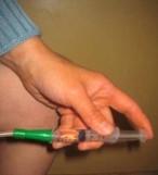 Technique to dissolve and manage Oxybutynin-managing oxybutynin-02.jpg